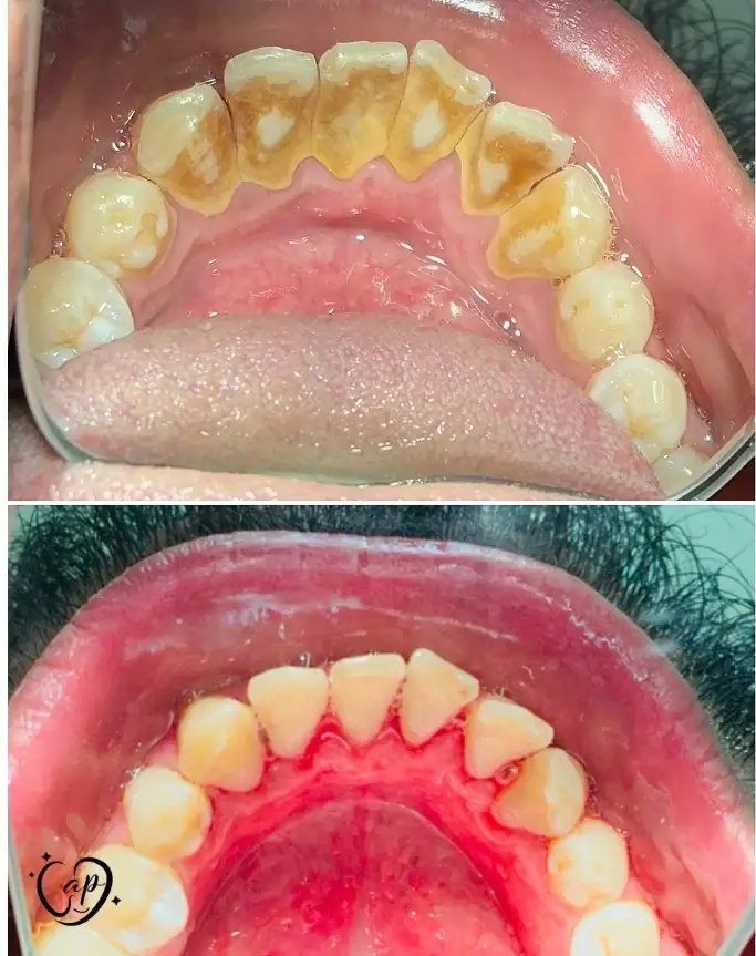 Professional dental care at CaP Dental Clinic