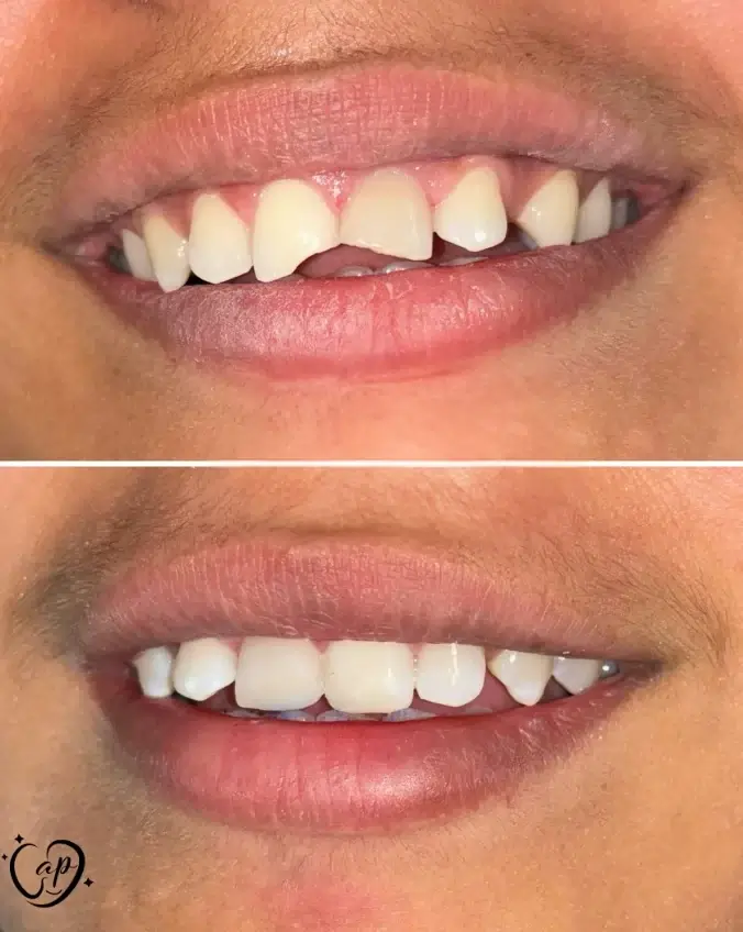 Advanced dental procedures at CaP Dental Clinic